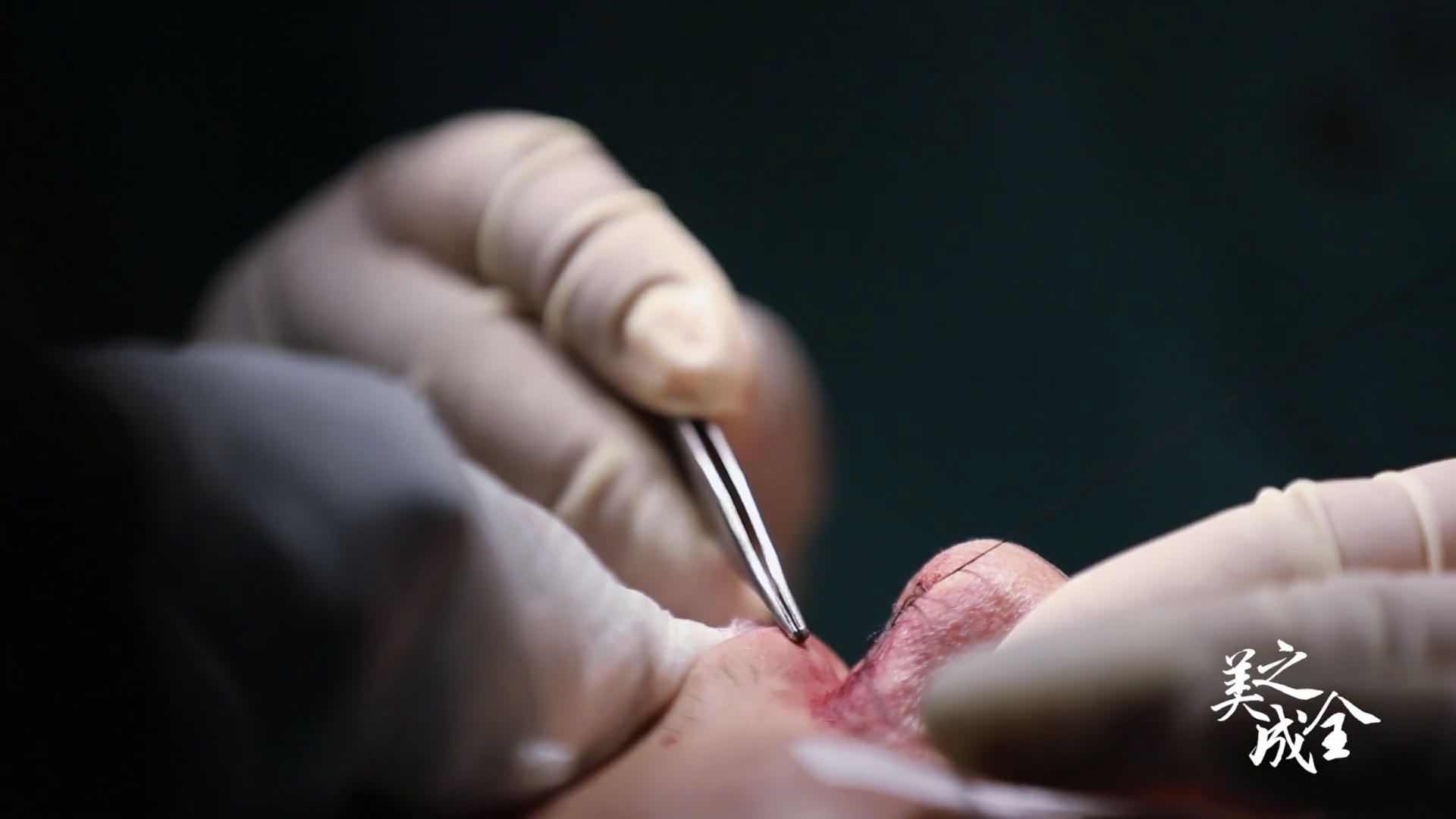 【醫(yī)者】面裂少年 “我想和你們一樣”