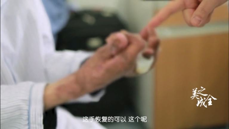 毛發(fā)移植可以為您解除煩惱