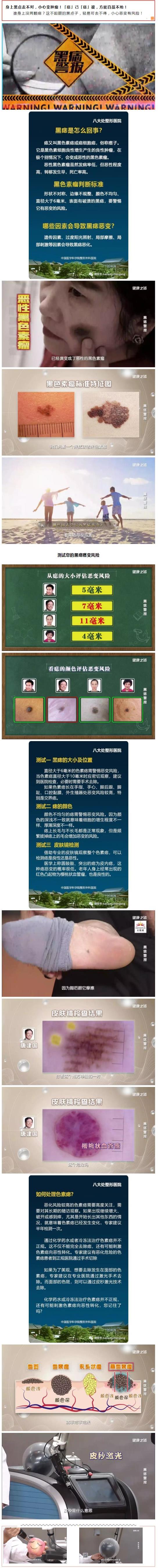 1584950535317.jpg 微信 《健康之路》黑痣警報(bào).jpg